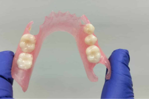 Lee más sobre el artículo Prótesis dental flexible