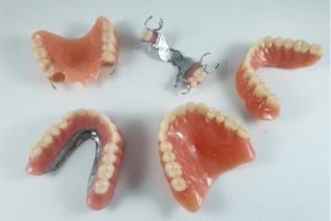 Lee más sobre el artículo Prótesis dental removible