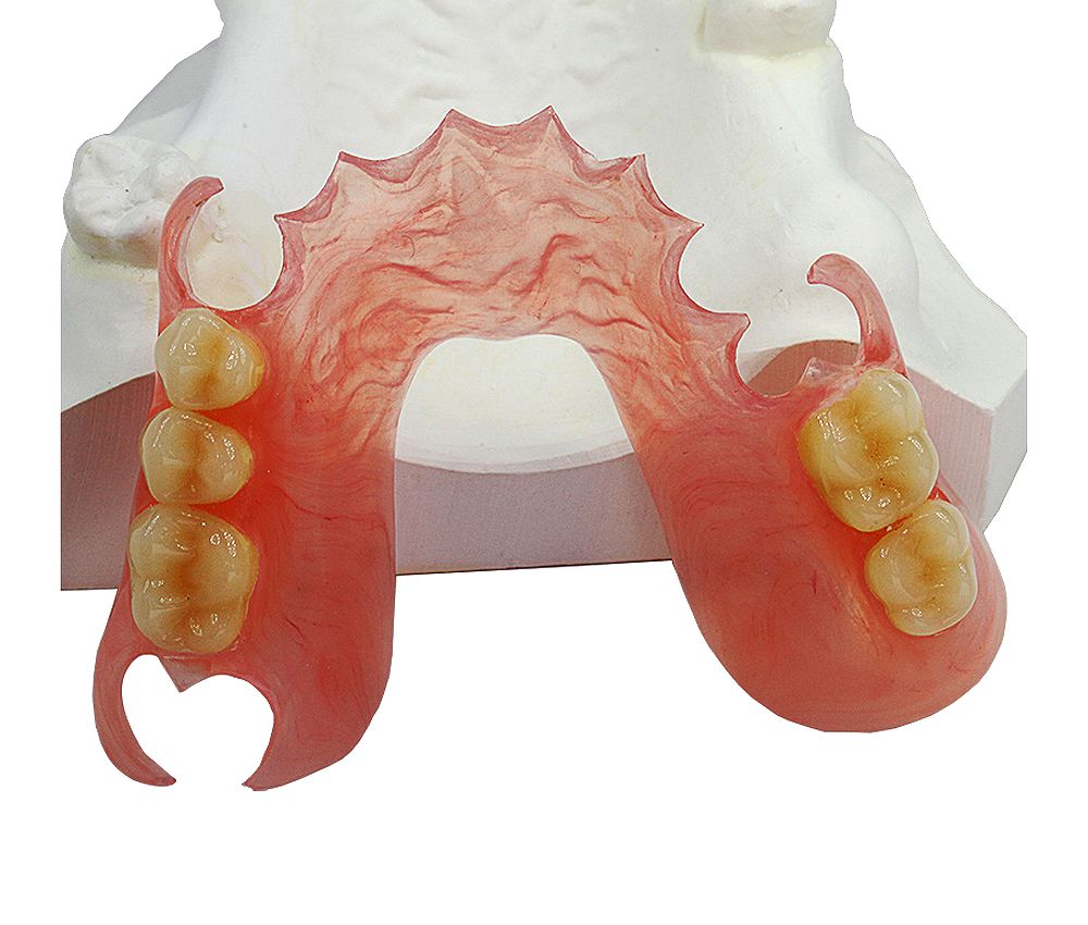 Prótesis dental flexible