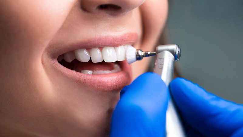 Dentista Puente Alto