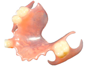 Prótesis flexible valplast