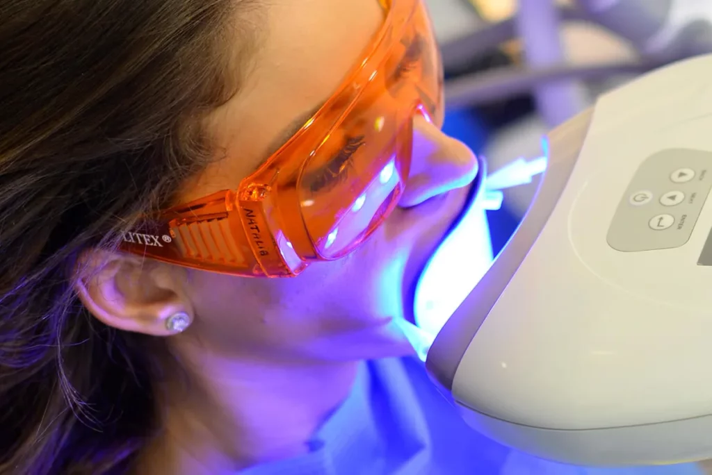 Blanqueamiento dental