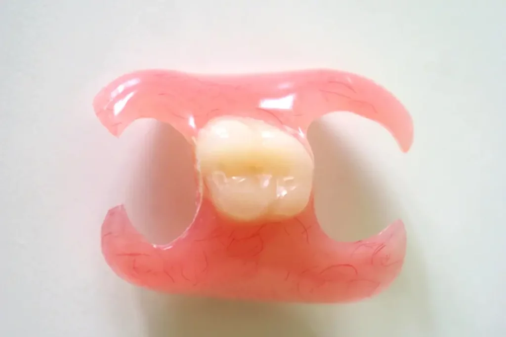 Prótesis dental unitaria