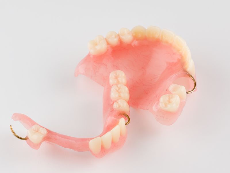 Prótesis dental Puentre Alto