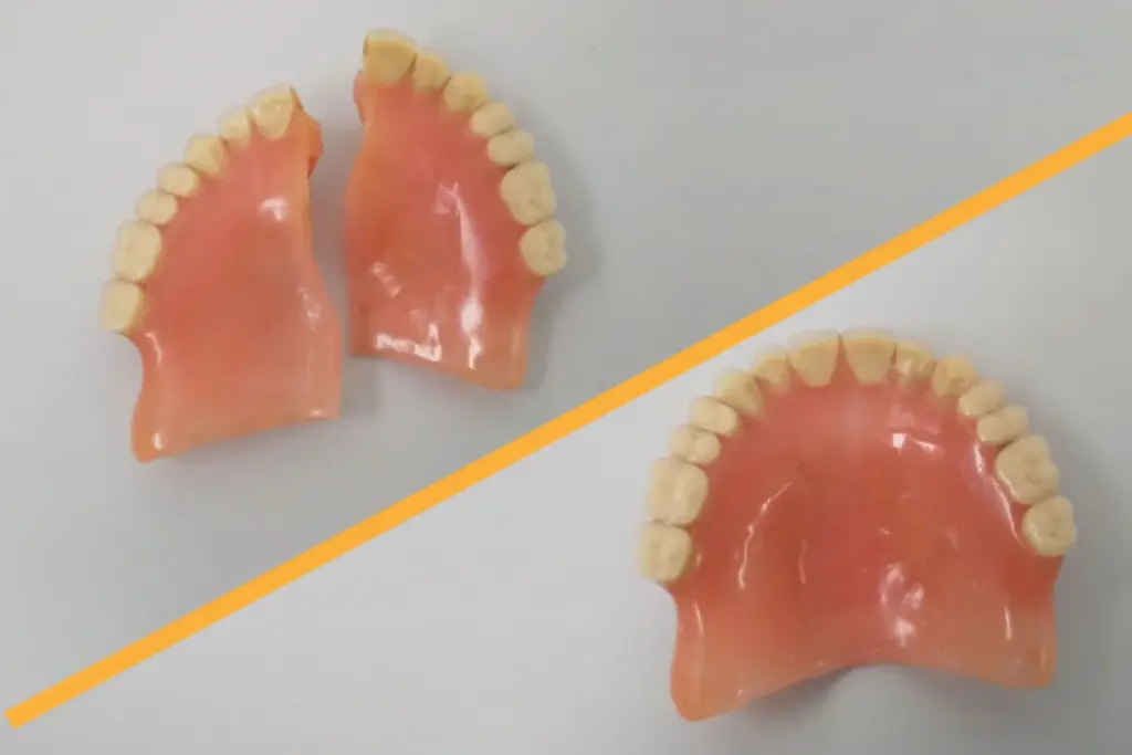 Reparación de Prótesis Dentales