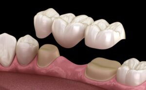 Dentistas La Florida